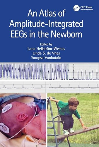 An Atlas of Amplitude-integrated Eegs in the Newborn
