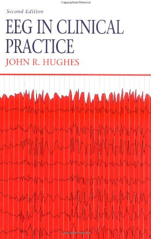 Eeg in Clinical Practice
