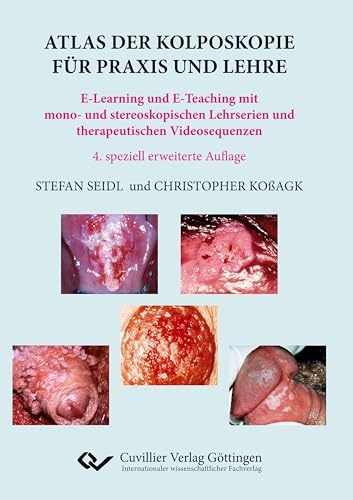 Atlas der Kolposkopie für Praxis und Lehre: E-Learning und E-Teaching mit mono- und stereoskopischen Lehrserien und therapeutischen Videosequenzen