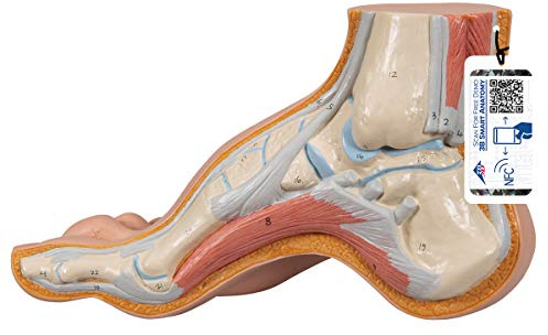 3B Scientific Menschliche Anatomie - Modell - Hohlfuß (Pes cavus) + kostenlose Anatomie App - 3B Smart Anatomy, M32
