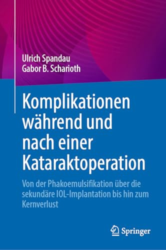 Komplikationen während und nach einer Kataraktoperation: Von der Phakoemulsifikation über die sekundäre IOL-Implantation bis hin zum Kernverlust (German Edition)