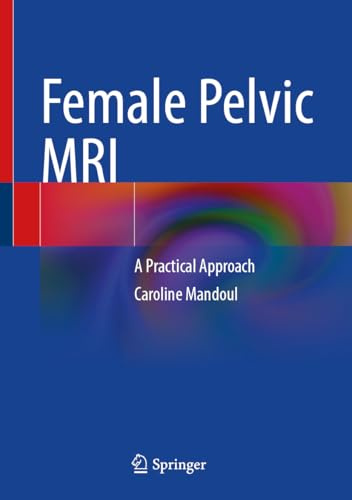 Female Pelvic MRI: A Practical Approach