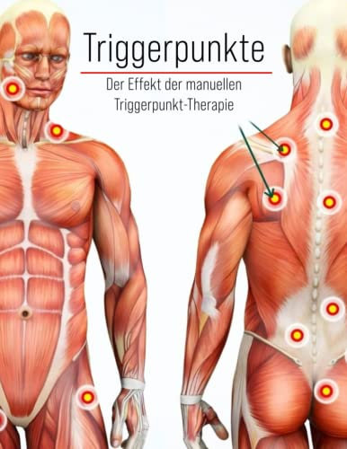 Triggerpunkte - Faszien Schmerzen - Referenzbuch Triggerpunkt Behandlung - Der Effekt der Manuellen Triggerpunkt Therapie