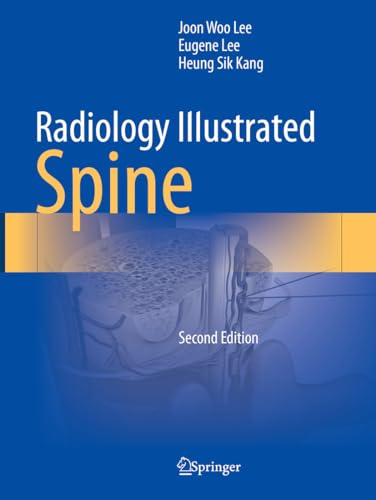 Radiology Illustrated: Spine