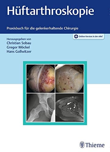 Hüftarthroskopie: Praxisbuch für die gelenkerhaltende Chirurgie