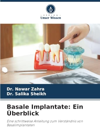 Basale Implantate: Ein Überblick: Eine schrittweise Anleitung zum Verständnis von Basalimplantaten