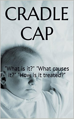 CRADLE CAP: What is it? What causes it? How is it treated? (English Edition)