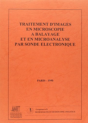 TRAITEMENT D'IMAGES EN MICROSCOPIE A BALAYAGE