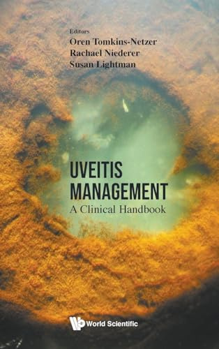 Uveitis Management: A Clinical Handbook