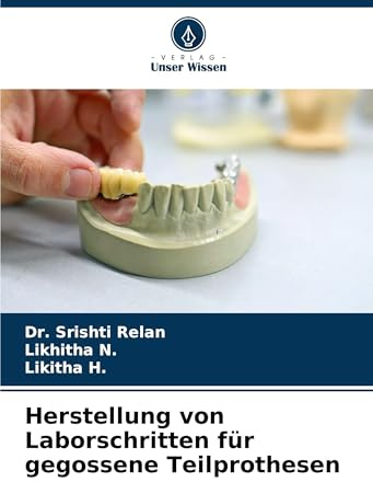 Herstellung von Laborschritten für gegossene Teilprothesen: DE