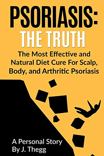 Psoriasis: The Truth: The Most Effective and Natural Diet Cure for Scalp, Body, and Arthritic Psoriasis (Psoriasis treatment psoriasis shampoo psoriasis cream psoriasis lotion, Band 1)