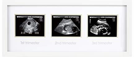 Pearhead 87038 Trimester Sonogram Frame Deluxe, Fotorahmen für drei Ultraschallaufnahmen, weiß