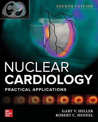 Nuclear Cardiology: Practical Applications