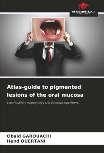 Atlas-guide to pigmented lesions of the oral mucosa: classification, frequencies and decision algorithms