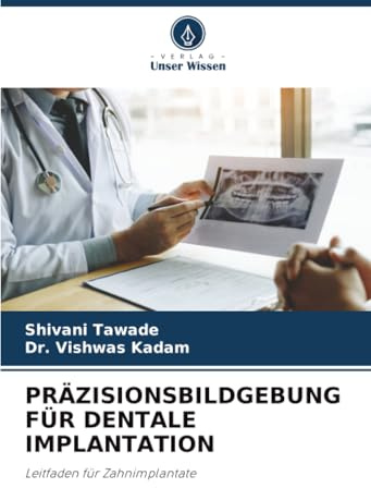 PRÄZISIONSBILDGEBUNG FÜR DENTALE IMPLANTATION: Leitfaden für Zahnimplantate