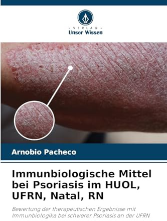 Immunbiologische Mittel bei Psoriasis im HUOL, UFRN, Natal, RN: Bewertung der therapeutischen Ergebnisse mit Immunbiologika bei schwerer Psoriasis an der UFRN