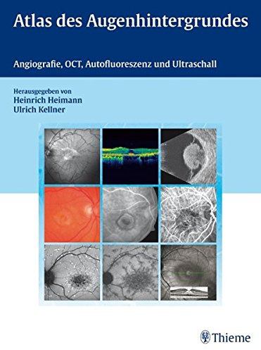 Atlas des Augenhintergrundes: Angiografie, OCT, Autofluoreszenz und Ultraschall