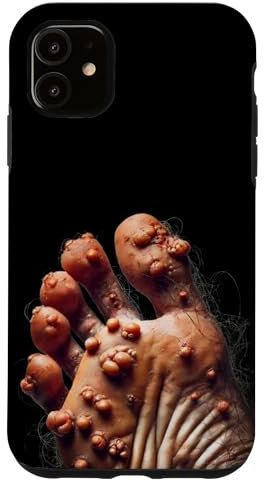Ugly Feet Case iPhone 11 Hülle Schutzhülle Glänzend Robuster Schutz Warzenfuß