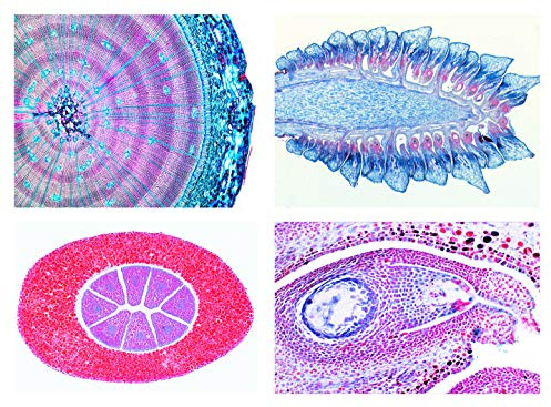 LIEDER Biologie Mikroskopie Mikropräparate Serien: Serie Nacktsamer (Gymnospermae), 15 Präparate