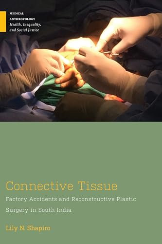 Connective Tissue: Factory Accidents and Reconstructive Plastic Surgery in South India (Medical Anthropology)