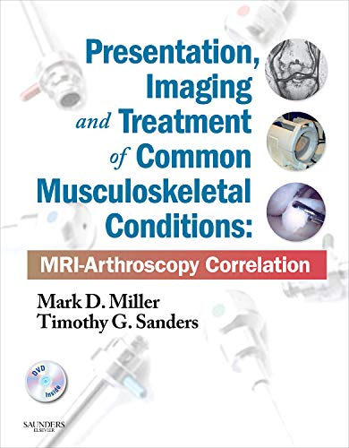 Presentation, Imaging and Treatment of Common Musculoskeletal Conditions: MRI-Arthroscopy Correlation (Expert Consult - Online and Print)