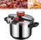 TRTDYFKH Olla de Alta presión con válvula de Escape y Cierre de Seguridad, Ajuste de presión de 3 velocidades, for Cocina de inducción, Estufa de Gas y Horno eléctrico.(10L)