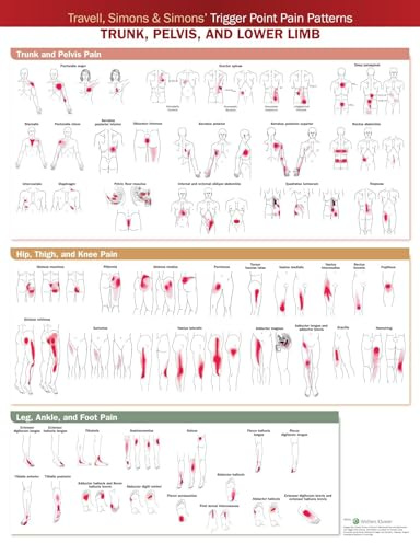 Travell, Simons & Simons’ Trigger Point Pain Patterns Wall Chart: Trunk, Pelvis, and Lower Limb