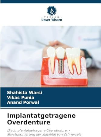 Implantatgetragene Overdenture: Die implantatgetragene Overdenture: - Revolutionierung der Stabilität von Zahnersatz