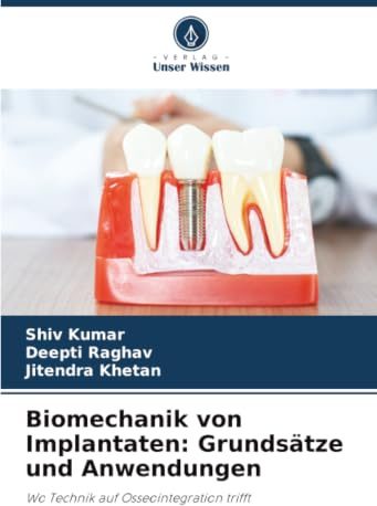 Biomechanik von Implantaten: Grundsätze und Anwendungen: Wo Technik auf Osseointegration trifft