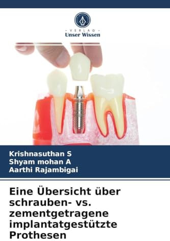 Eine Übersicht über schrauben- vs. zementgetragene implantatgestützte Prothesen