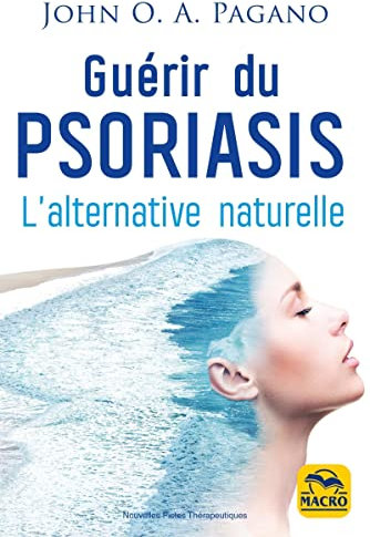 Guérir du psoriasis: L'alternative naturelle
