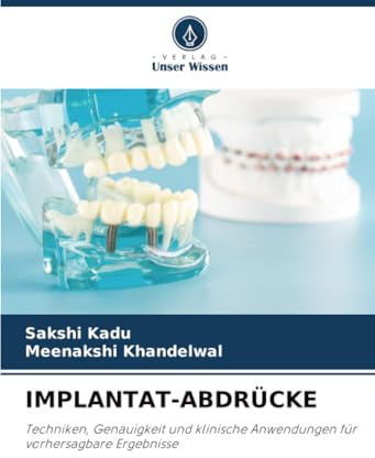 IMPLANTAT-ABDRÜCKE: Techniken, Genauigkeit und klinische Anwendungen für vorhersagbare Ergebnisse