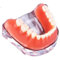 Natudeco Zahnärztliche Studienmodell untersuchen Modell Dental Maxillary Overdenture Model Minderwertiges Präzisionsimplantat Demo with 4 Implantats for Zahnarztlaborklinik Zahnarztköpfe