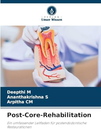 Post-Core-Rehabilitation: Ein umfassender Leitfaden für postendodontische Restaurationen