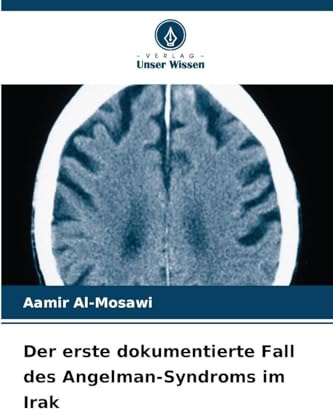 Der erste dokumentierte Fall des Angelman-Syndroms im Irak