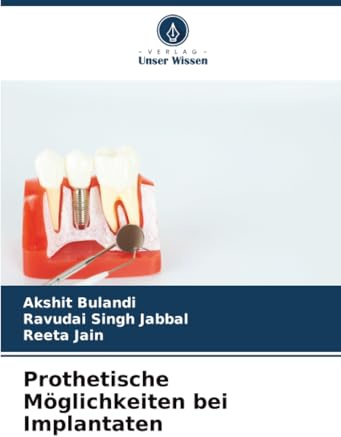 Prothetische Möglichkeiten bei Implantaten: DE