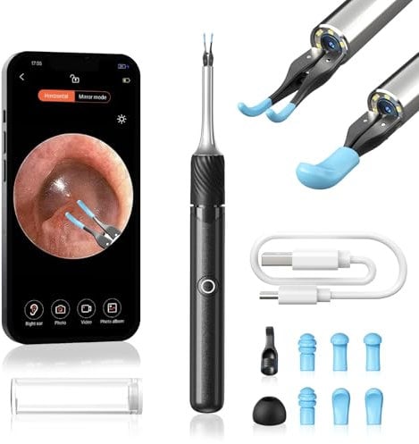 Qimic Ear Wax Removal with Tweezers - 1080P HD Cleaner Camera Omni-Direction Ear Pick Tweezer, Real-Time Remote Video, Multi Earwax Cleaning Replacement Kits