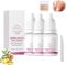 FungiGone Nail treatment, Fungigone Nail Fungus Removal,Fungigone Ginger Nail Essence,Nail Repair Growth Treatment Nail Softener for Thick Toenails Toe and Finger Nail Solution (3 Pcs)