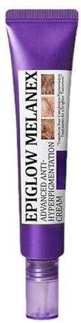Hyperpigmentation Treatment Cream,Anti Pigmentation Removal Cream,Dark Spot Remover for Face,Face Cream for Melasma Hyperpigmentation, Spot Treatment for All Skin Type