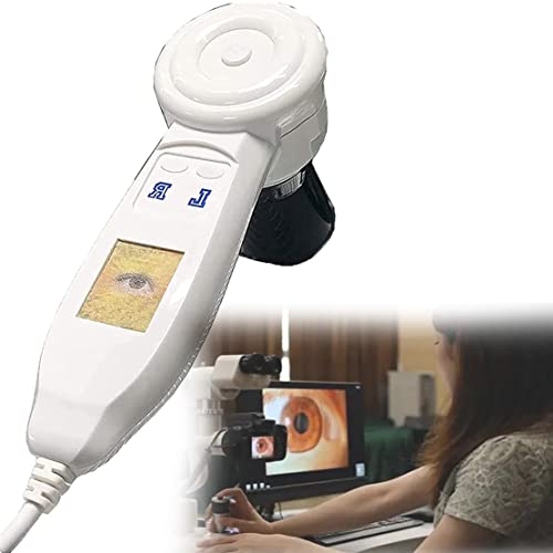 CYMYYDS Tragbarer Iris-Detektor, 2 Millionen Pixel hohe Auflösung 2560 * 1920 Iris-Kamera Pathologisches Analysegerät, HD 30x Iris-Linse und treiberfreie Analysesoftware