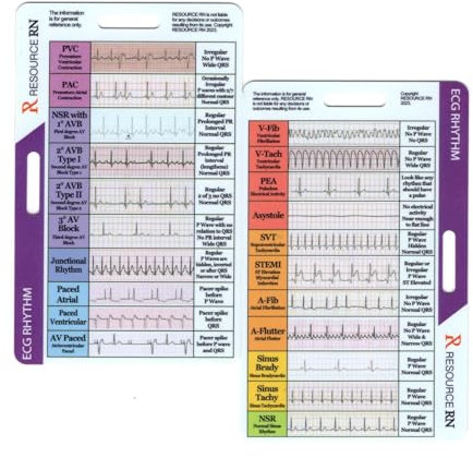 EKG/EKG Rhythmus Taschenkarte, Doppelseitiges Design EKG Rhythmus Interpretations Abzeichenkarte, Buddy Pflege Spickzettel mit EKG-Linealmessung für Krankenschwestern, EKG-Techniker, Studenten