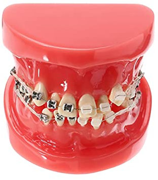 Modelo Dental Estándar, Tratamiento Ortodóncico Dental, Modelo Dental con Cadena De Alambre Metálico, Modelo De Demostración Oral para La Comunicación Dental con El Paciente