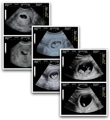 Generisch Fake Ultraschallbild Schwangerschaft – Lustiges Ultraschallfoto Scherzartikel, realistische Baby Scan Bilder, witziges Geschenk für Paare, Ehemann, Ehefrau, Partner, Überraschung, Spaß