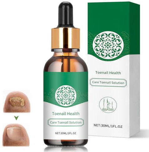 Trattamenti per Unghie, Micosi Unghie Piedi,Trattamento Antimicotico Unghie Piedi Nutre e Lenisce Le Unghim,Rinforza la Struttura Dell'Unghia, 30ml