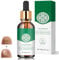 Trattamenti per Unghie, Micosi Unghie Piedi,Trattamento Antimicotico Unghie Piedi Nutre e Lenisce Le Unghim,Rinforza la Struttura Dell'Unghia, 30ml