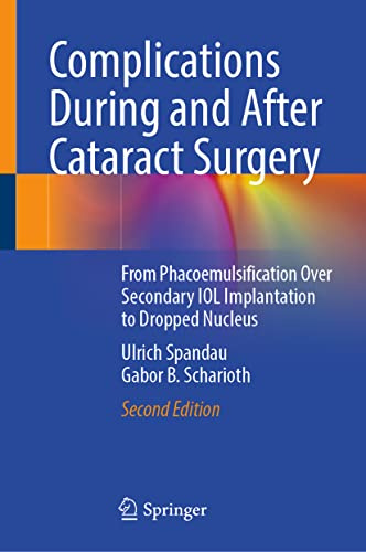 Complications During and After Cataract Surgery: From Phacoemulsification Over Secondary IOL Implantation to Dropped Nucleus