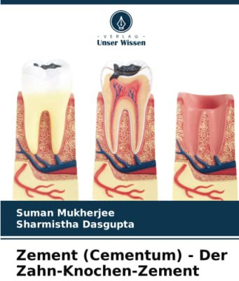 Zement (Cementum) - Der Zahn-Knochen-Zement