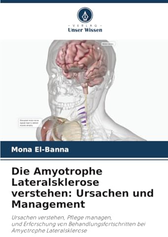 Die Amyotrophe Lateralsklerose verstehen: Ursachen und Management: Ursachen verstehen, Pflege managen,und Erforschung von Behandlungsfortschritten beiAmyotrophe Lateralsklerose