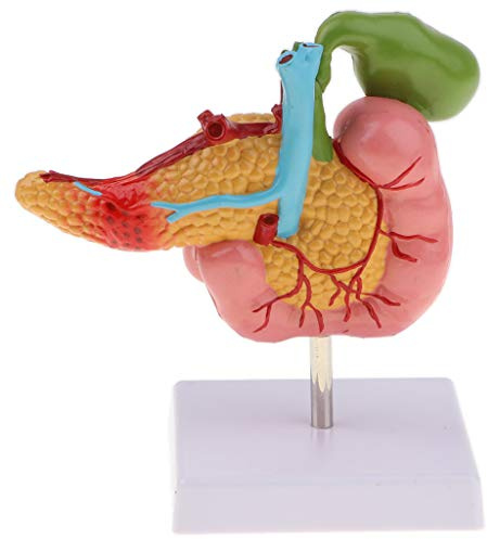 Pankreasmodell 1:1 Anatomisches Duodenum Gallenblase Pathologisches Lehrmittel