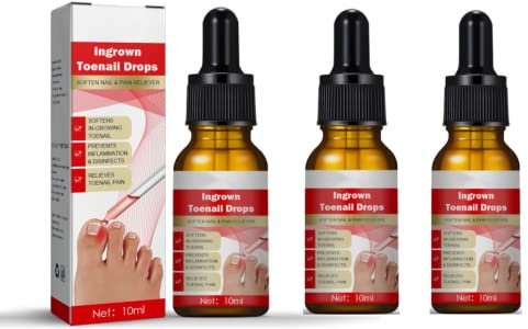 Nail Repair Essence,Nail Repair Essence Nail Repair Cleaning,for Repair Damaged, and Discolored Nails (3Pcs)
